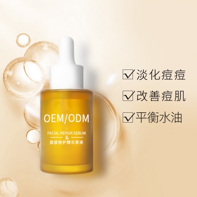 永川区_祛痘精华原液OEM